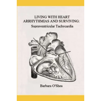 Living with Heart Arrhythmias and Surviving: Supraventricular Tachycardia